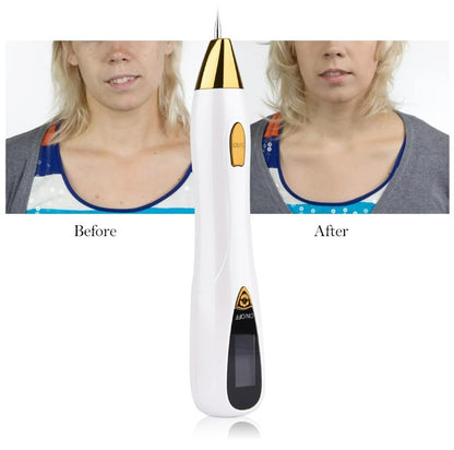 Skin Care Laser Mole, Tattoo Freckle, Wart Corns Dark Spot Removal Pen LCD - Silver