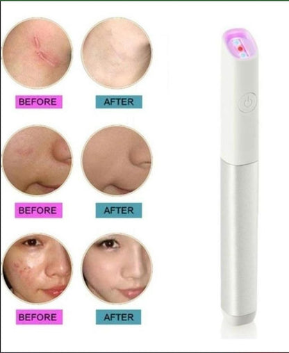 Blue/Red Light Machine for Anti-Inflammation Acne Scar Removal Wrinkle Removal Treatment Skin Tightening